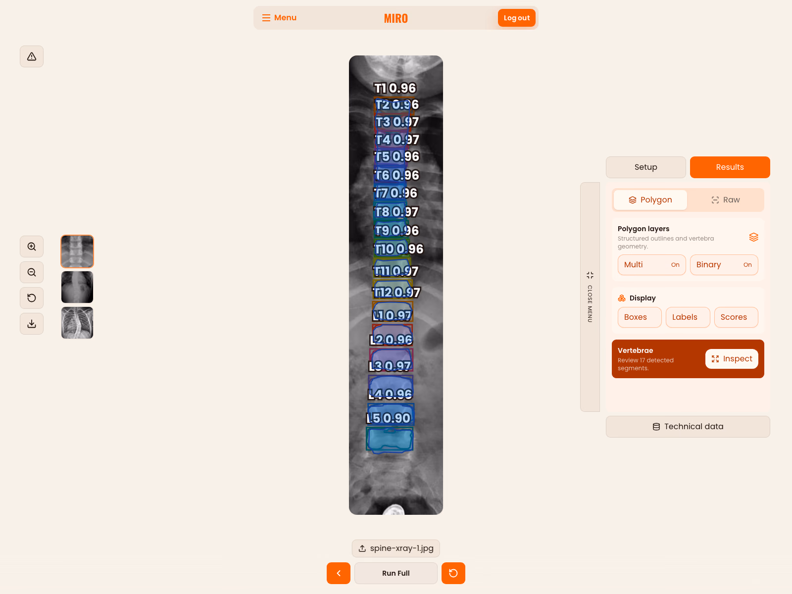 MIRO result workspace showing a demonstration spine radiograph with colored vertebra polygons and labels beside Polygon and Raw view controls.